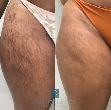 Home whatsapp image 2025 05 06 at 13 (1)